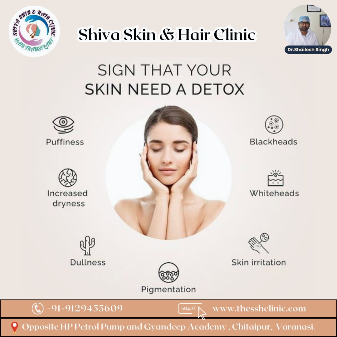 Best Dermatologist in Varanasi -Dr.Shailesh Singh. - The SSH Clinic